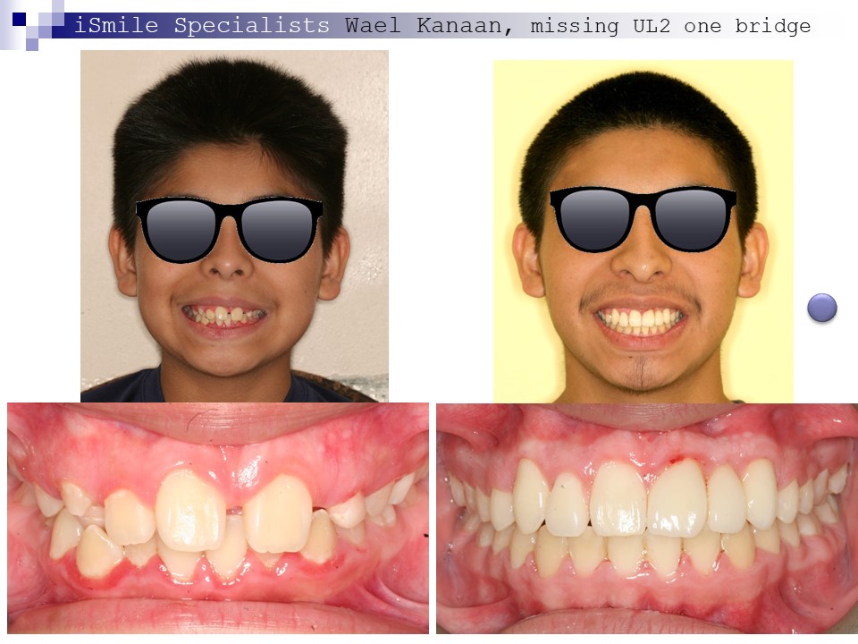 presentation of orthodontic cases