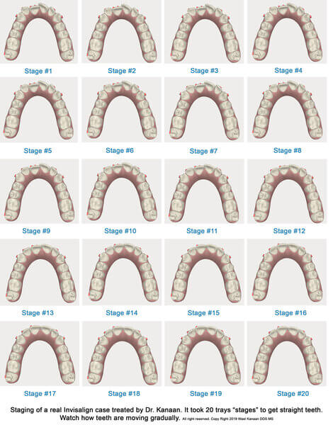 Top Invisalign Providers in Houston and Sugar Land, Texas